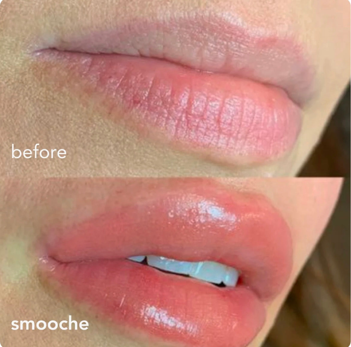 Strength plumper lip